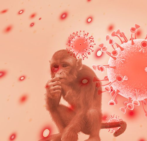 «Оспа обезьян»