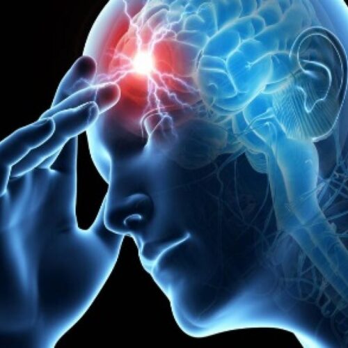 11.02.2025 Что такое инсульт?